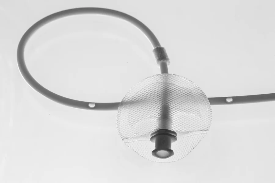Complex Catheter Assembly Silicone Component Assembly
